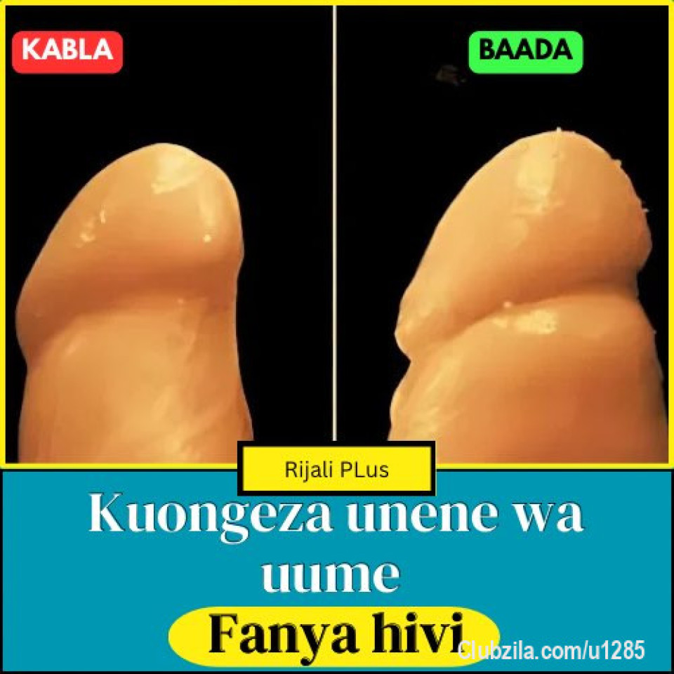 KUONGEZA UNENE WA UUME

Uume mrefu bila nyama hainogi 

Je, uume unaweza kuonekana mnene na una-body flani hivi?

Jibu ni yes!!

Wanawake wengi wanasema wazi kwamba unene wa uume unaongeza msisimko, pressure, na ile feeling ya kujazwa vizuri (tuambiane ukweli bana).

Sasa badala ya kwenda kutafuta mizizi kichochoroni nakupa njia 4 za kuongeza unene wa uume kwa  usalama,na matokeo ya uhakika

(SUBSCRIBE KWENYE UKURASA WANGU KUPATA MUENDELEZO WA MAKALA HII NA  TIPS NYINGINE NYINGI ZA UHAKIKA KUHUSU AFYA / MAHUSIANO )